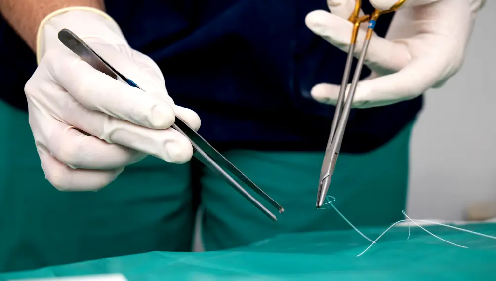 Mastering the Grip: Why Premium Surgical Forceps are the Backbone of Modern Clinical Precision